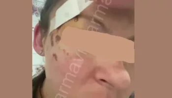 В Краснодарском крае селянка 3 недели скрывала изнасилование школьником