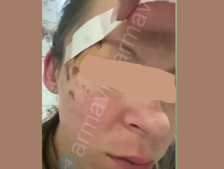 В Краснодарском крае женщина требует наказать подростка-маньяка