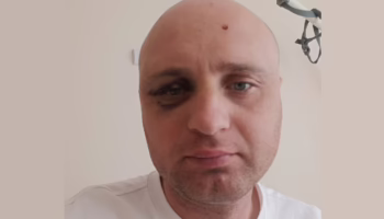 Депутата Евгения Олиференко обвинили в избиении мужчины и девушки